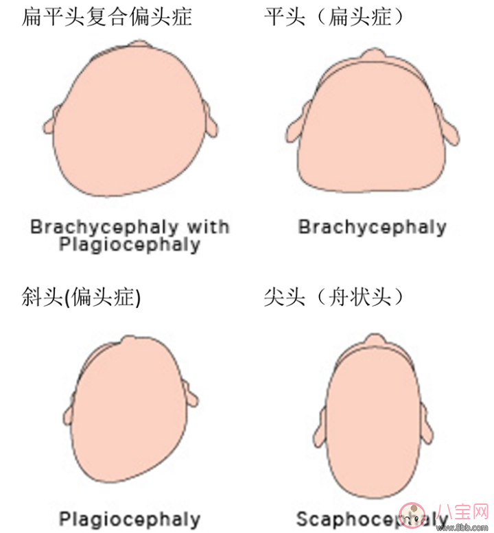 <a href=/tag/yufang/ target=_blank class=infotextkey>预防</a><a href=/tag/baobao/ target=_blank class=infotextkey>宝宝</a><a href=/tag/pingtou/ target=_blank class=infotextkey>平<a href=/tag/tou/ target=_blank class=infotextkey>头</a></a>扁<a href=/tag/tou/ target=_blank class=infotextkey>头</a> <a href=/tag/yinger/ target=_blank class=infotextkey><a href=/tag/ying/ target=_blank class=infotextkey>婴</a>儿</a><a href=/tag/ruhe/ target=_blank class=infotextkey>如何</a>塑造好<a href=/tag/touxing/ target=_blank class=infotextkey><a href=/tag/tou/ target=_blank class=infotextkey>头</a>型</a> 定型<a href=/tag/zhentou/ target=_blank class=infotextkey>枕<a href=/tag/tou/ target=_blank class=infotextkey>头</a></a><a href=/tag/meiyong/ target=_blank class=infotextkey>没用</a>